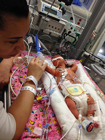 niña-bebe-enfermedad-sindrome-de-berdon-mmhis-megavejiga-microcolon-hipoperistalsis